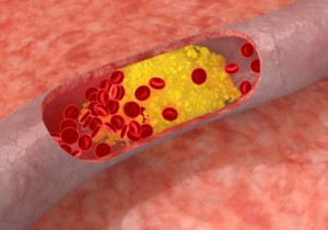 Cholesterolio koncentracija | cholesterolis.com nuotr.