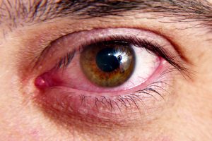 Akių ligos | Rengėjų nuotr.