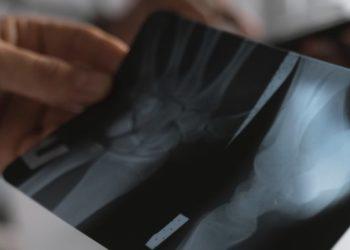 Kaip apsisaugoti nuo susižeidimų?