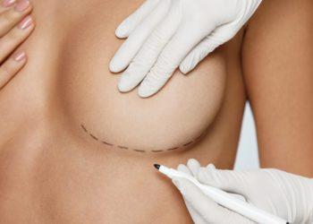 Krūtų pakėlimo operacija tikrai leis prisiminti jaunystę