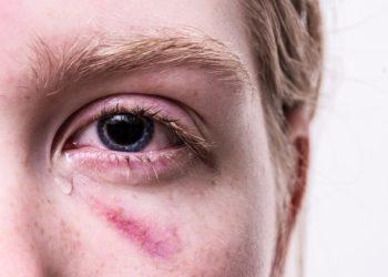 Siūloma įteisinti apsaugos nuo smurto artimoje aplinkoje orderį