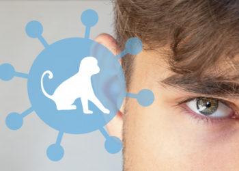 Lietuvoje – pirmas beždžionių raupų atvejis