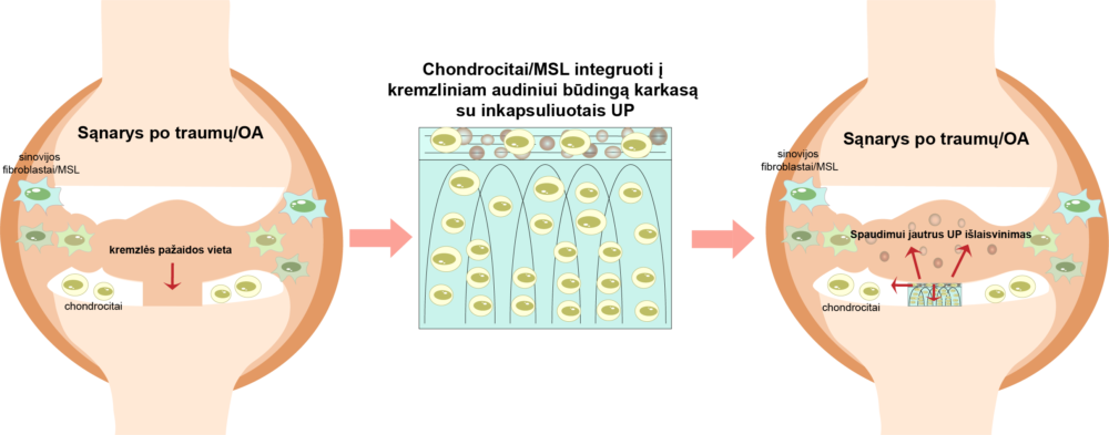 Kremzliniam audiniui būdingo karkaso su inkapsuluotomis užląstelinėmis pūslėmis panaudojimo kremzlės gydymui schema