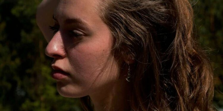 Kaip įveikti paaugliškas odos bėdas